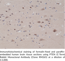 PTEN (C-Term) Rabbit Monoclonal Antibody (Clone RM265)