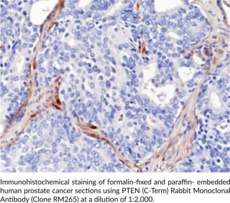 PTEN (C-Term) Rabbit Monoclonal Antibody (Clone RM265)