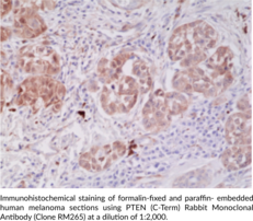 PTEN (C-Term) Rabbit Monoclonal Antibody (Clone RM265)