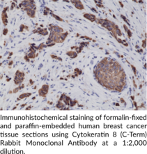 Cytokeratin 8 (C-Term) Rabbit Monoclonal Antibody (Clone RM266)