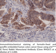 p16INK4A (C-Term) Rabbit Monoclonal Antibody (Clone RM267)