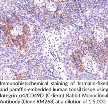 Integrin α4/CD49D (C-Term) Rabbit Monoclonal Antibody (Clone RM268)