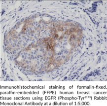 EGFR (Phospho-Tyr1173) Rabbit Monoclonal Antibody (Clone RM269)