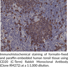 CD20 (C-Term) Rabbit Monoclonal Antibody (Clone RM272)