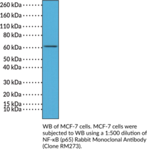 NF-κB (p65) Rabbit Monoclonal Antibody (Clone RM273) (Nuclear Factor NF-κB p65 Subunit, Transcription Factor p65)