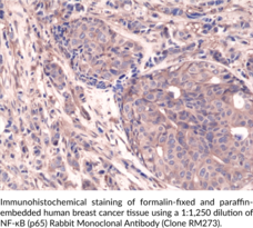 NF-κB (p65) Rabbit Monoclonal Antibody (Clone RM273)