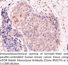 mTOR Rabbit Monoclonal Antibody (Clone RM274)
