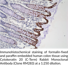 JAM-A (N-Term) Rabbit Monoclonal Antibody (Clone RM275)
