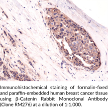 β-Catenin Rabbit Monoclonal Antibody (Clone RM276)