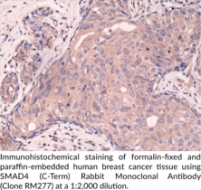 SMAD4 (C-Term) Rabbit Monoclonal Antibody (Clone RM277)
