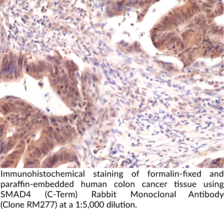 SMAD4 (C-Term) Rabbit Monoclonal Antibody (Clone RM277)