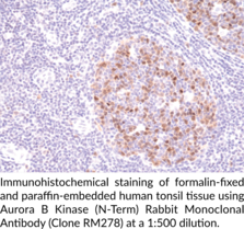 Aurora B Kinase (N-Term) Rabbit Monoclonal Antibody (Clone RM278)