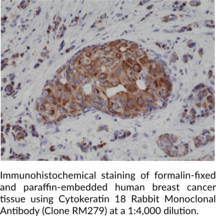 Cytokeratin 18 Rabbit Monoclonal Antibody (Clone RM279)