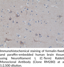 Neurofilament L (C-Term) Rabbit Monoclonal Antibody (Clone RM280)