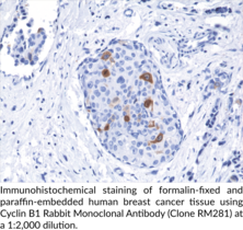 Cyclin B1 Rabbit Monoclonal Antibody (Clone RM281)