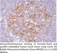Cyclin B1 Rabbit Monoclonal Antibody (Clone RM281)