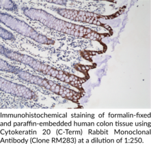 Cytokeratin 20 (C-Term) Rabbit Monoclonal Antibody (Clone RM283)