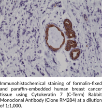 Cytokeratin 7 (C-Term) Rabbit Monoclonal Antibody (Clone RM284)
