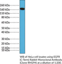 EGFR (C-Term) Rabbit Monoclonal Antibody (Clone RM294) (Epidermal Growth Factor Receptor, ErbB-1, HER1)