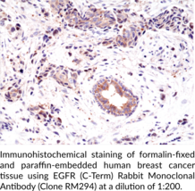 EGFR (C-Term) Rabbit Monoclonal Antibody (Clone RM294)