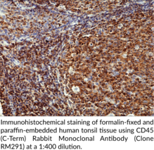CD45 (C-Term) Rabbit Monoclonal Antibody (Clone RM291)