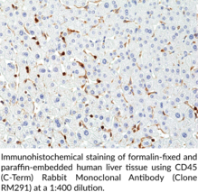 CD45 (C-Term) Rabbit Monoclonal Antibody (Clone RM291)