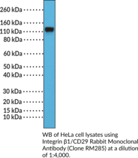 Integrin β1/CD29 Rabbit Monoclonal Antibody (Clone RM285) (Cluster of Differentiation 29, GPIIa, ITGB1, Fibronectin Receptor Subunit β, Platelet Glycoprotein IIa, VLA-4 Subunit β)
