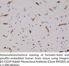 Integrin β1/CD29 Rabbit Monoclonal Antibody (Clone RM285)