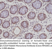 Integrin β1/CD29 Rabbit Monoclonal Antibody (Clone RM285)