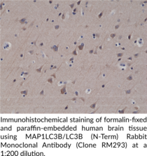 MAP1LC3B/LC3B (N-Term) Rabbit Monoclonal Antibody (Clone RM293)