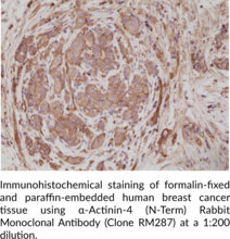 α-Actinin-4 (N-Term) Rabbit Monoclonal Antibody (Clone RM287)