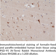 PSD-95 (N-Term) Rabbit Monoclonal Antibody (Clone RM288)