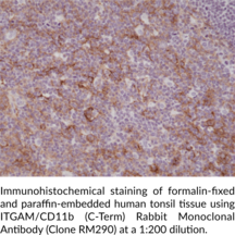 ITGAM/CD11b (C-Term) Rabbit Monoclonal Antibody (Clone RM290)