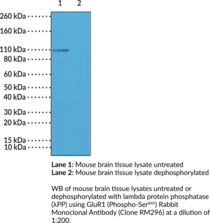 GluR1 (Phospho-Ser845) Rabbit Monoclonal Antibody (Clone RM296) (AMPA-selective Glutamate Receptor 1, GluA1, GluR-1, GluR-A)