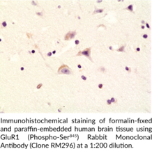GluR1 (Phospho-Ser845) Rabbit Monoclonal Antibody (Clone RM296)
