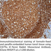 CD79a (C-Term) Rabbit Monoclonal Antibody (Clone RM297)