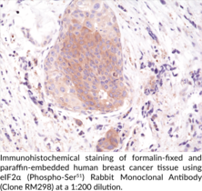 eIF2α (Phospho-Ser51) Rabbit Monoclonal Antibody (Clone RM298)