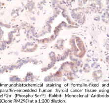eIF2α (Phospho-Ser51) Rabbit Monoclonal Antibody (Clone RM298)