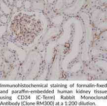 CD34 (C-Term) Rabbit Monoclonal Antibody (Clone RM300)