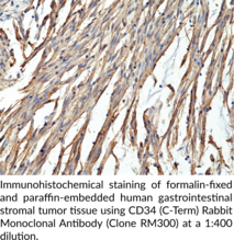 CD34 (C-Term) Rabbit Monoclonal Antibody (Clone RM300)