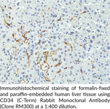 CD34 (C-Term) Rabbit Monoclonal Antibody (Clone RM300)