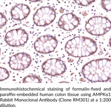 AMPKα1 Rabbit Monoclonal Antibody (Clone RM301)