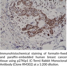 p27Kip1 (C-Term) Rabbit Monoclonal Antibody (Clone RM302)
