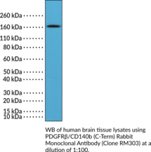 PDGFRβ/CD140b (C-Term) Rabbit Monoclonal Antibody (Clone RM303) (CD140 Antigen-like Family Member B, PDGFR-1, Platelet-derived Growth Factor Receptor 1, Platelet-derived Growth Factor Receptor β)