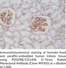 PDGFRβ/CD140b (C-Term) Rabbit Monoclonal Antibody (Clone RM303)