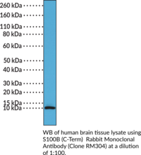 S100B (C-Term) Rabbit Monoclonal Antibody (Clone RM304) (S100 Calcium-binding Protein B, S100 Protein β Chain, S100 Protein Subunit β, S100β)