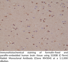 S100B (C-Term) Rabbit Monoclonal Antibody (Clone RM304)
