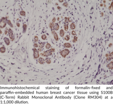 S100B (C-Term) Rabbit Monoclonal Antibody (Clone RM304)