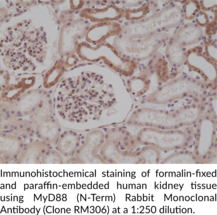 MyD88 (N-Term) Rabbit Monoclonal Antibody (Clone RM306)