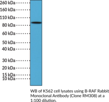B-RAF Rabbit Monoclonal Antibody (Clone RM308) (B-RAF Proto-oncogene, Proto-oncogene B-RAF, RAFB1, Serine/Threonine Kinase, V-Raf Murine Sarcoma Viral Oncogene Homolog B)